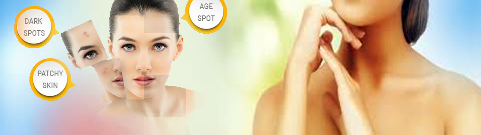 Acne,pimples treatment in pune